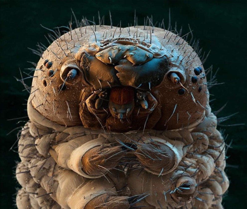 2. Гусеница под микроскопом. интересное, удивительные фотографии, фото