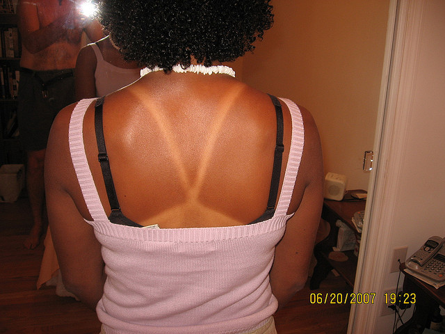 13. Эти полоски 13. Эти полоски загар, люди