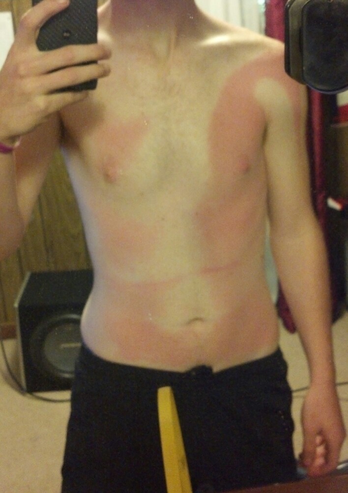 8. Так намазался солнцезащитным кремом 8. Так намазался солнцезащитным кремом загар, люди