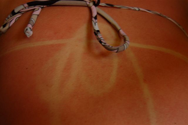 19. Художественно получилось 19. Художественно получилось загар, люди